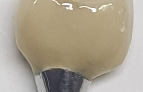 Prótesis dental