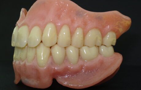 Prótesis dental